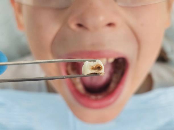 Best Urgent Dental Care for Toothaches in Seagoville, TX