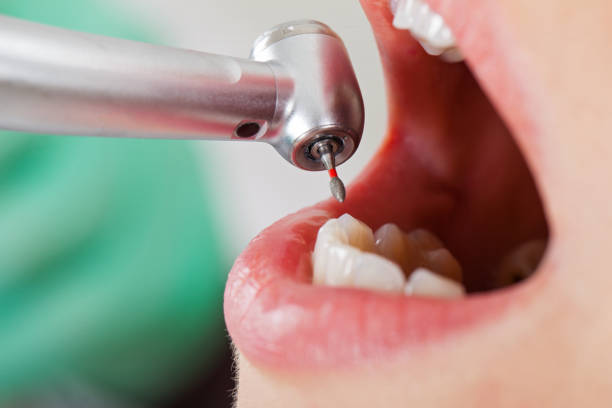 Best Emergency Care for Gum Disease in Seagoville, TX